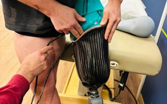 Researchers at Simon Fraser University have developed a 3D printed prosthetic limb socket that uses embedded pressure sensors and artificial intelligence to generate custom socket designs, based on individual patient biomechanics